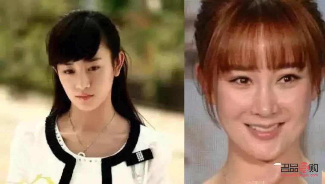 5g桃花眼双眼皮恢复期多久(5g桃花眼双眼皮能管多久)