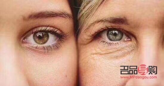 <h3>眼皮下垂缺什么营养</h3>