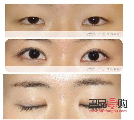 做的双眼皮和自然的区别(做的双眼皮和自然的区别是什么)