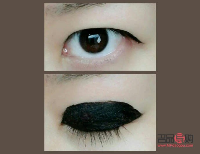 埋线双眼皮风险探析：美丽背后的隐患与应对策略