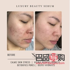 <h3>学美容要皮肤好吗</h3>