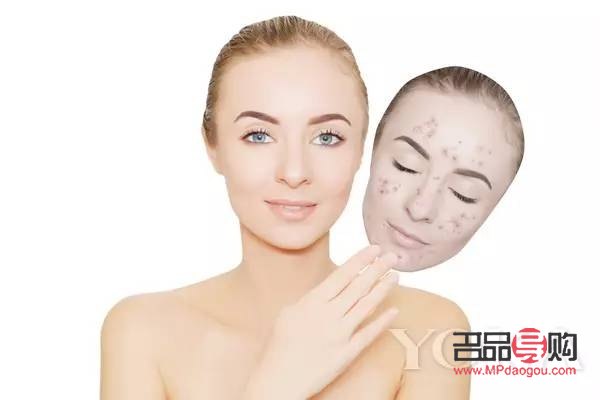 <h3>美容院祛斑好吗？专业解析与选择建议</h3>