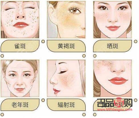 <h3>美容院祛斑好吗？专业解析与选择建议</h3>