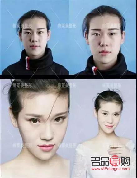 双眼皮哪种形态好看(双眼皮哪种形态好看一点)