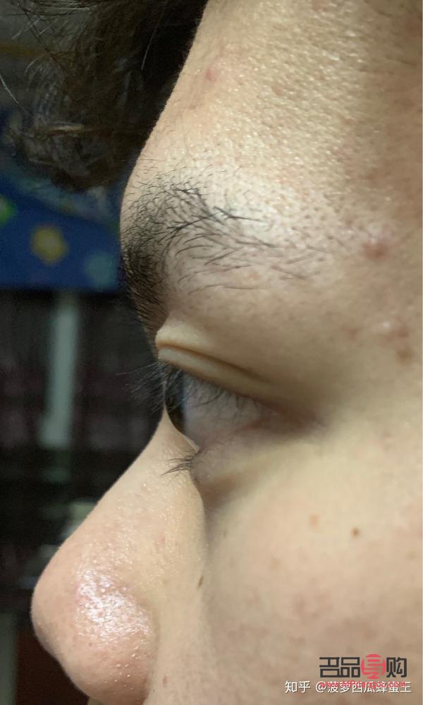 眼凸的图片(眼凸的图片大全) 眼凸的图片(眼凸的图片大全)