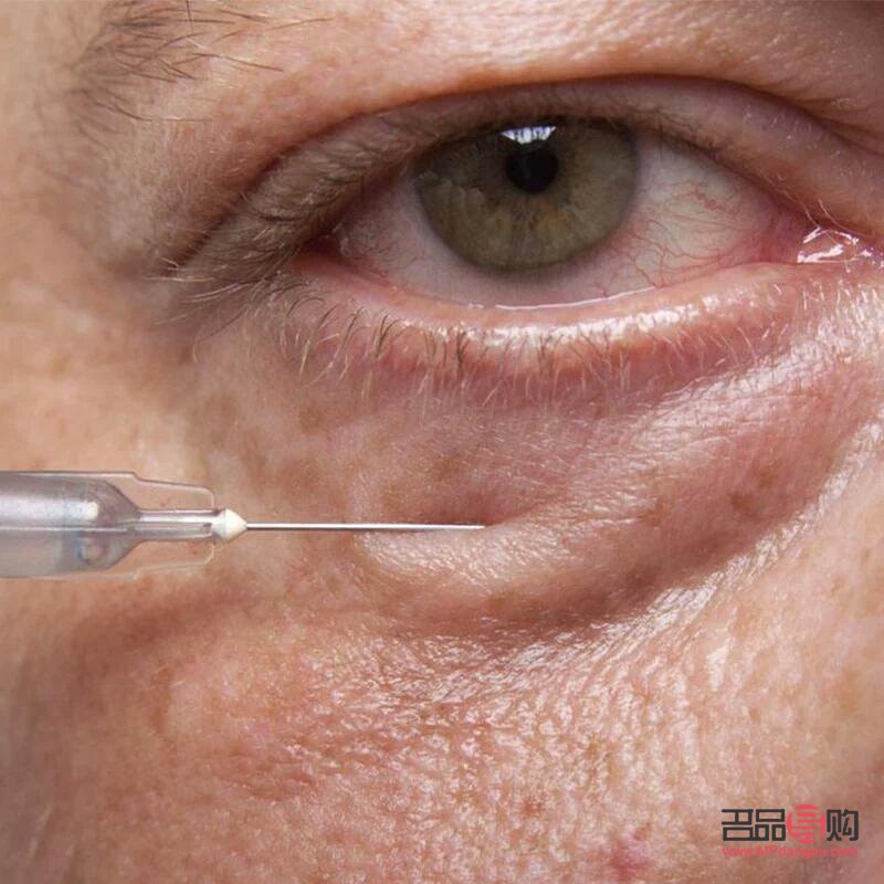 怎么消除眼袋最有效的办法(怎么消除眼袋最有效的办法松弛)