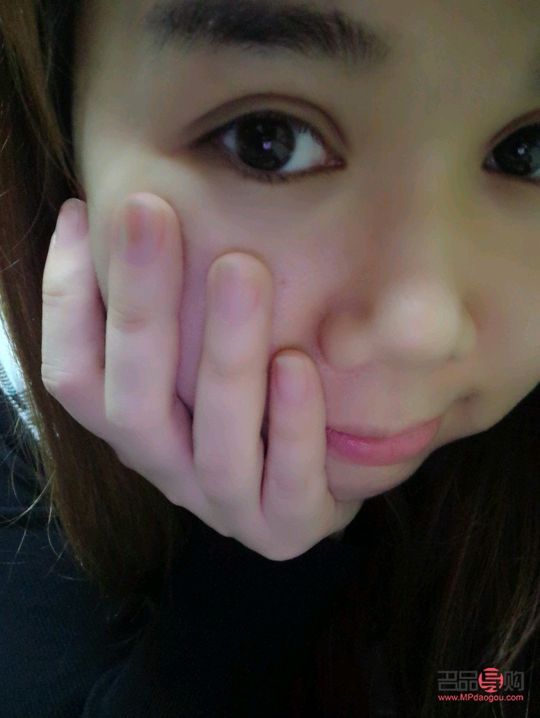 <h3>埋线双眼皮两次,打造迷人电眼</h3> <h3>埋线双眼皮两次,打造迷人电眼</h3>