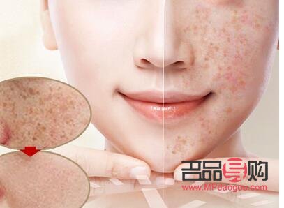 岫岩美容祛斑大揭秘：哪家才是你的最佳选择？