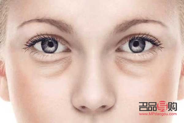 自己去眼袋的绝招(消除眼袋的最有效方法)