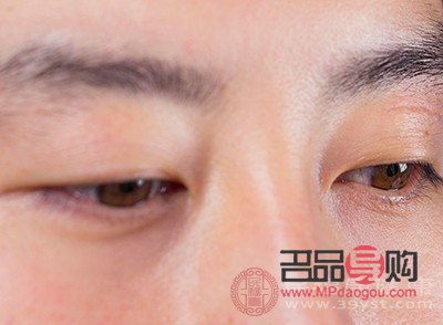 眼部神经痉挛能自愈吗(眼部神经痉挛能自愈吗吃什么药)