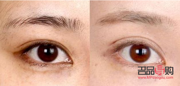 内双怎么才能变成双眼皮(内双怎么才能变成双眼皮小技巧) 内双怎么才能变成双眼皮(内双怎么才能变成双眼皮小技巧)
