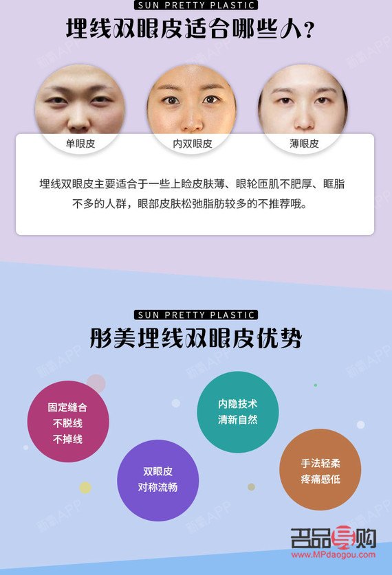 松解双眼皮,打造自然明眸 松解双眼皮,打造自然明眸