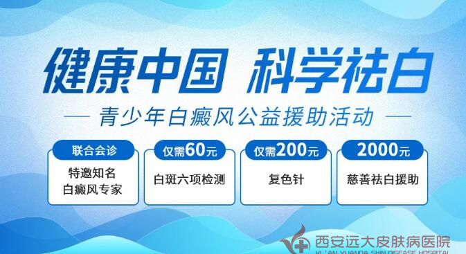 2025西安远大暑期白癜风公益援助|京陕三甲专家会诊+治疗补贴60元起