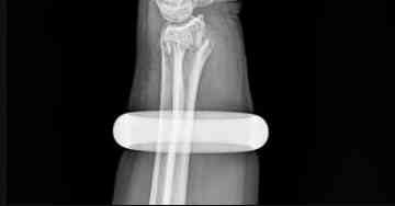 戴着玉镯睡觉的禁忌(戴玉镯睡觉会影响健康吗)插图1