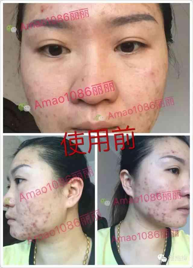 碧玉化妆品是微商吗(碧肌肤是微商吗)