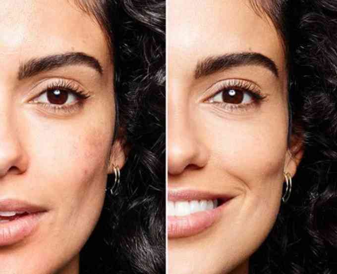 瑕疵皮大毛孔化妆品能用吗(瑕疵皮大毛孔化妆品能用吗女生)