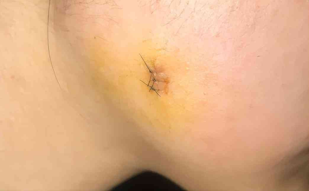 良心国货化妆品消疤(国货祛疤膏)插图12