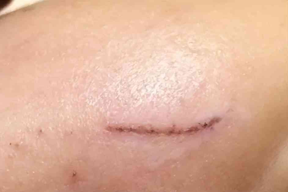 良心国货化妆品消疤(国货祛疤膏)插图13