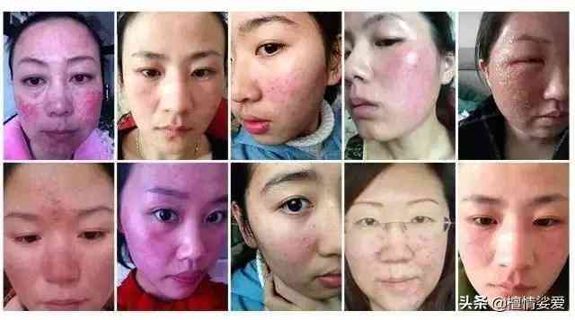 用含激素的化妆品的危害(用含激素的化妆品有什么危害)插图7