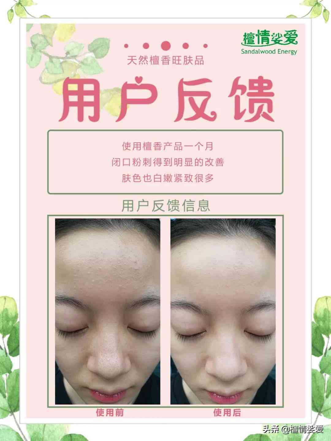 用含激素的化妆品的危害(用含激素的化妆品有什么危害)插图9
