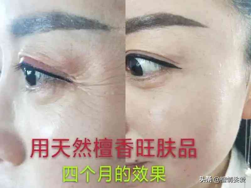 用含激素的化妆品的危害(用含激素的化妆品有什么危害)插图11