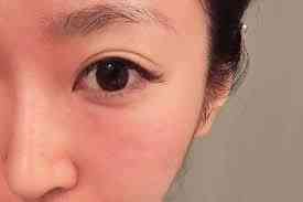 乳酸锌化妆品(乳酸锌是什么)插图1