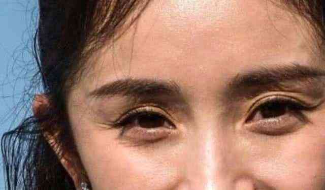 乳酸锌化妆品(乳酸锌是什么)插图5