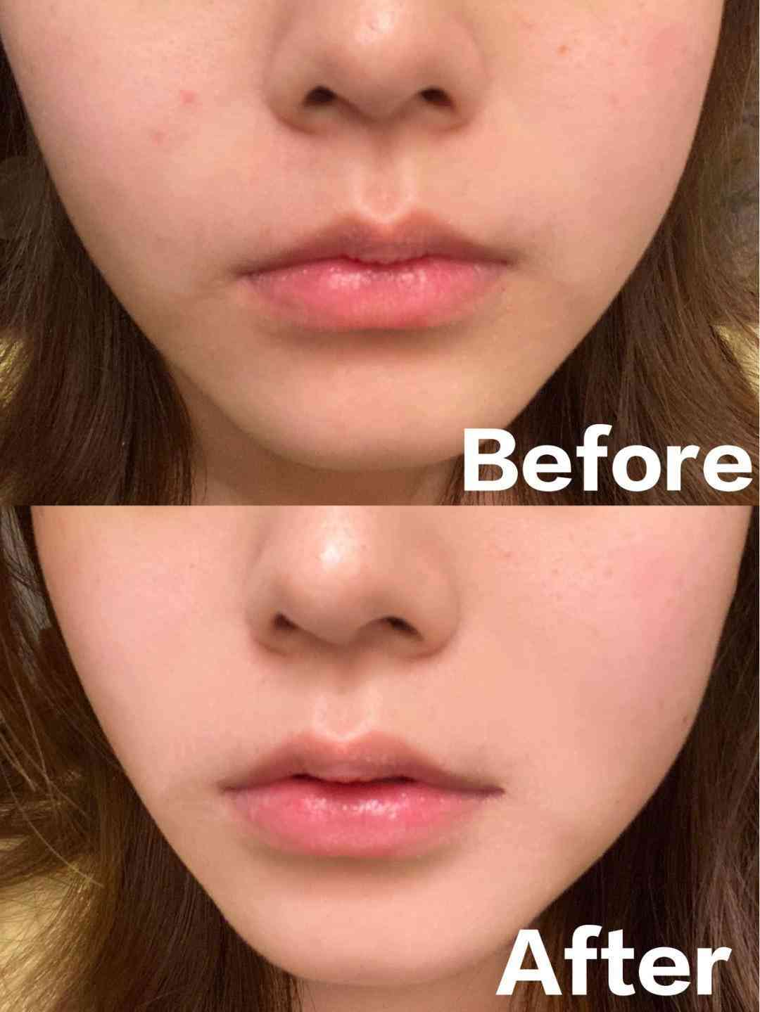 乳酸锌化妆品(乳酸锌是什么)插图25