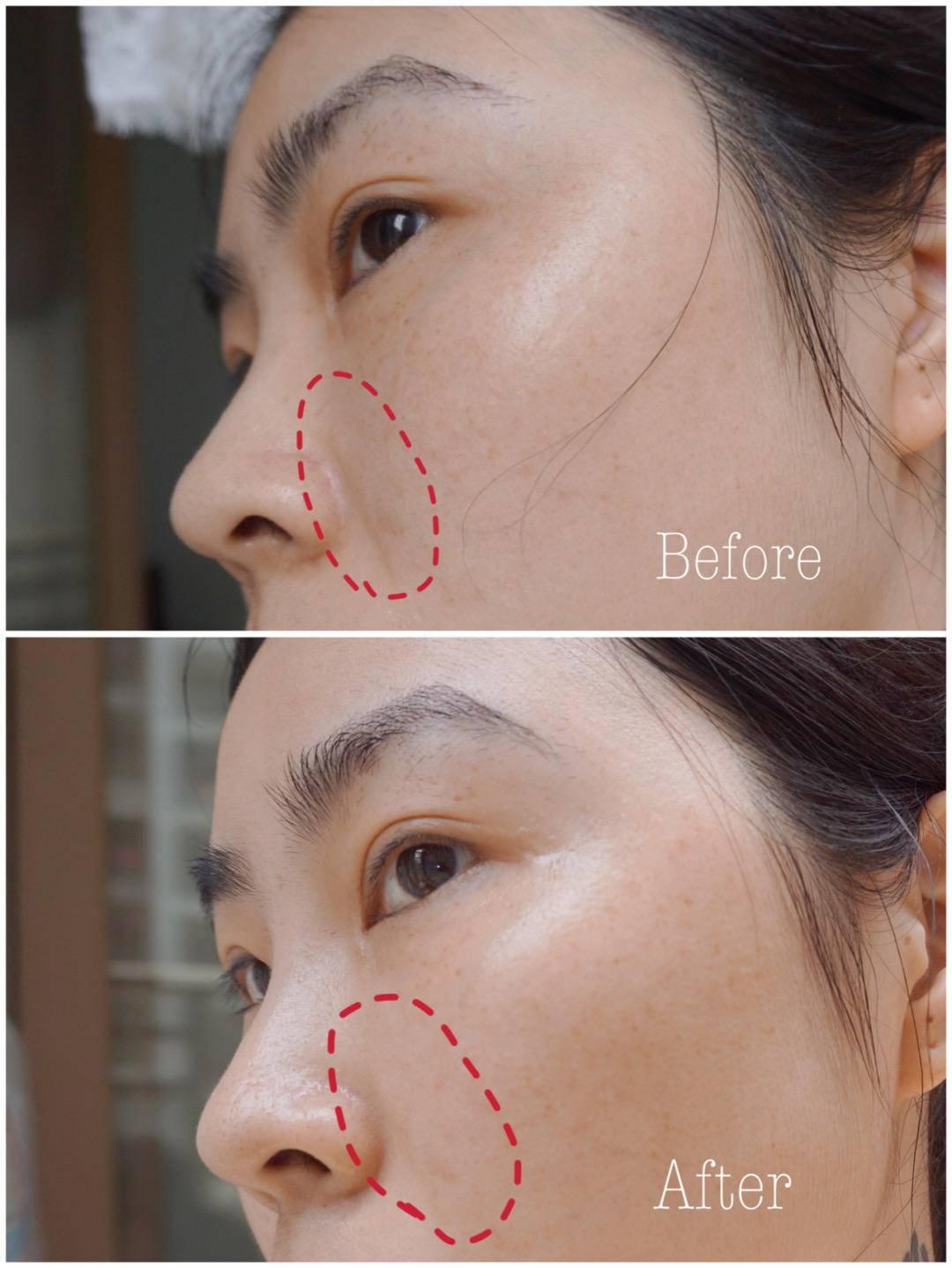 乳酸锌化妆品(乳酸锌是什么)插图28