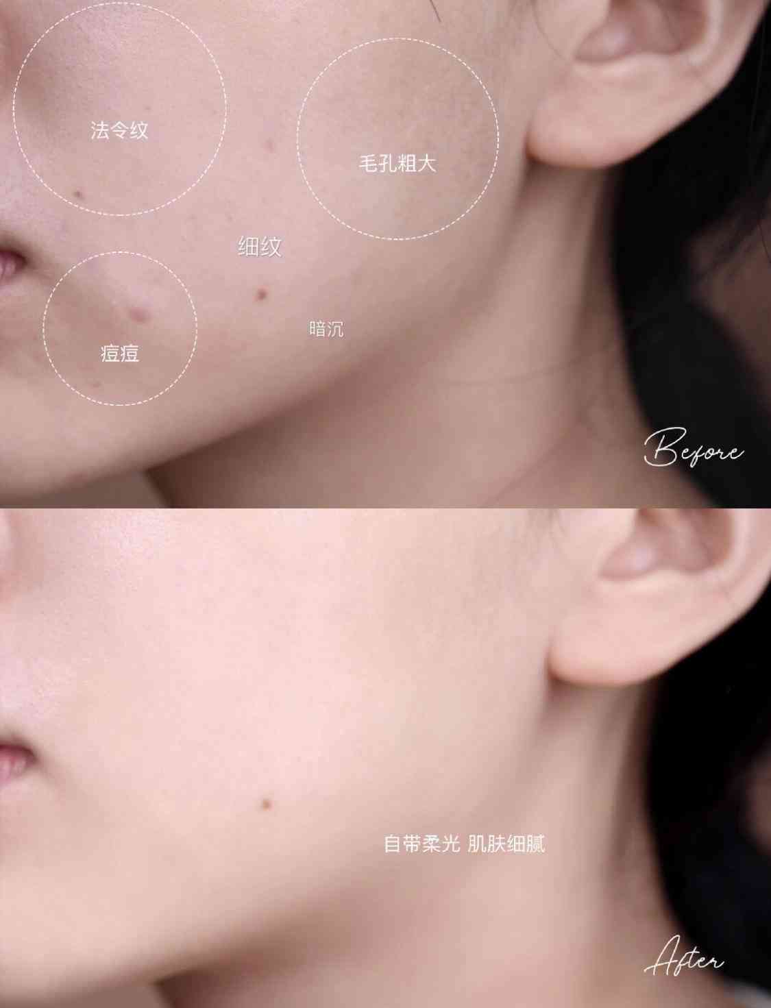 乳酸锌化妆品(乳酸锌是什么)插图34