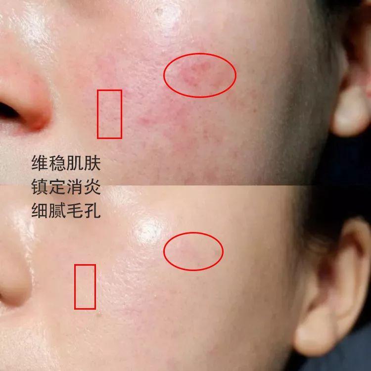 林依晨化妆品分析(林依晨妆容)插图12 林依晨化妆品分析(林依晨妆容)插图12