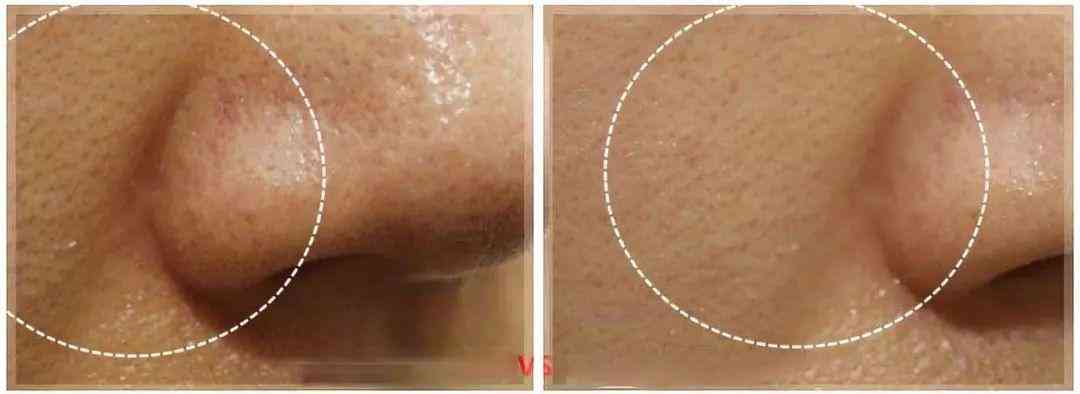 林依晨化妆品分析(林依晨妆容)插图31 林依晨化妆品分析(林依晨妆容)插图31