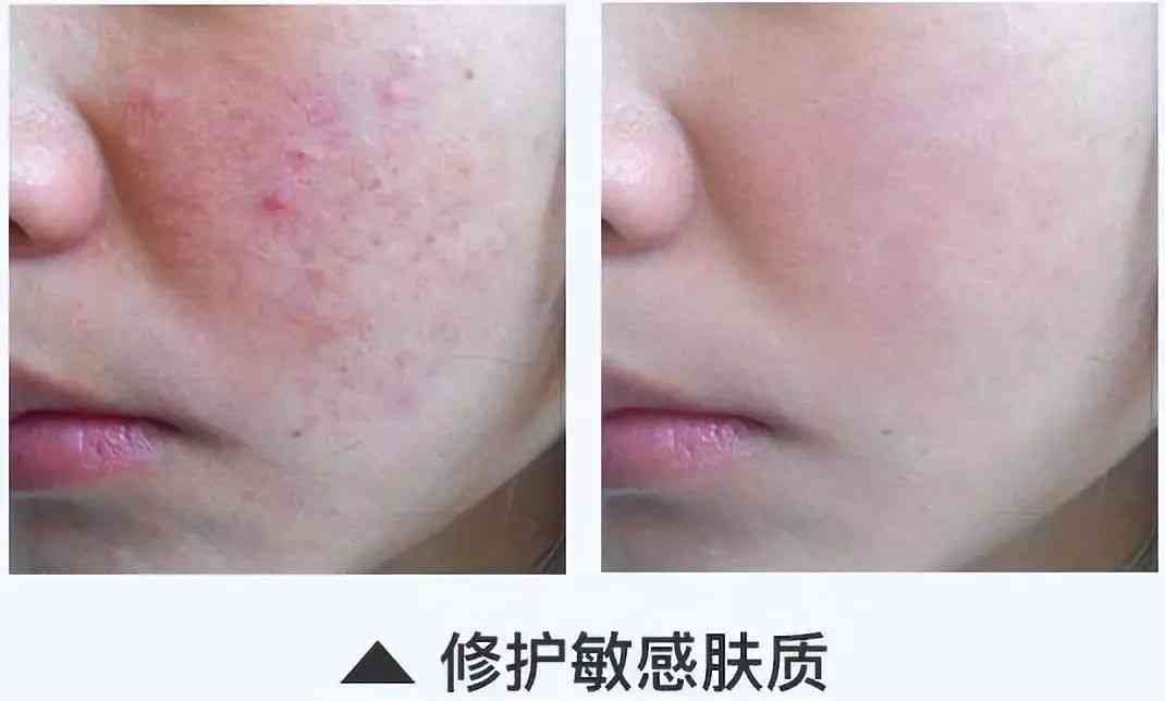 林依晨化妆品分析(林依晨妆容)插图34 林依晨化妆品分析(林依晨妆容)插图34