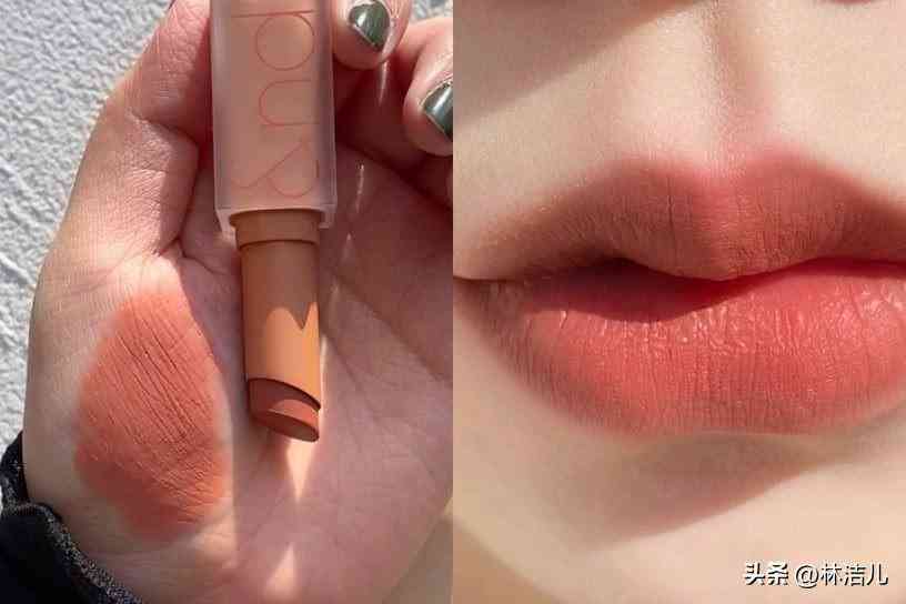 买什么韩国化妆品(白内障的早期眼球图片)插图16