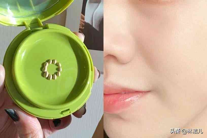 买什么韩国化妆品(白内障的早期眼球图片)插图23