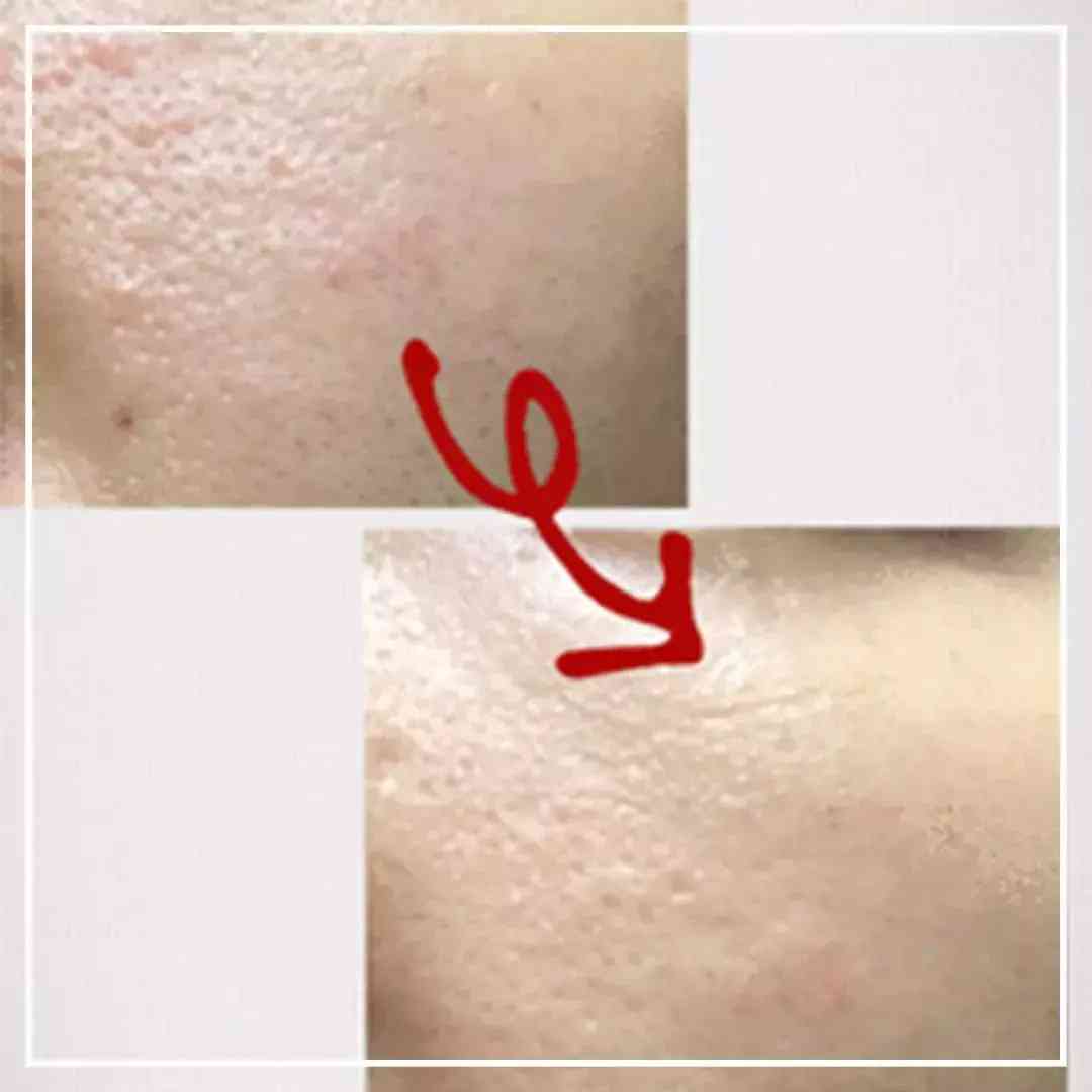 伊索套装化妆品怎么样(伊雅索护肤品怎么样)插图25