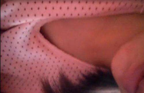 化妆品乳水刺痛(水乳有刺痛感)