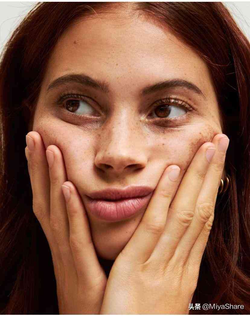 化妆品不当长痘该怎办(乱用化妆品导致长痘)插图2