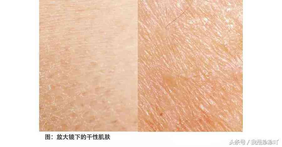 化妆品皮试位置图(护肤品皮试操作流程)插图1 化妆品皮试位置图(护肤品皮试操作流程)插图1