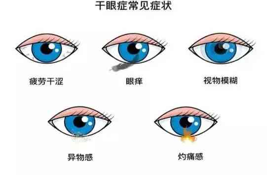 化妆品进到眼睛里及时清洗(清洗剂进眼睛了)插图1