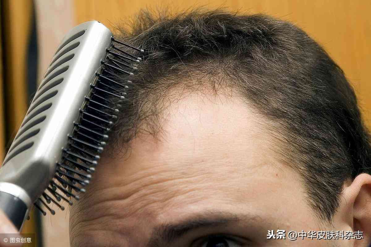 育发类化妆品的活性成分(什么成分可以育发)插图1