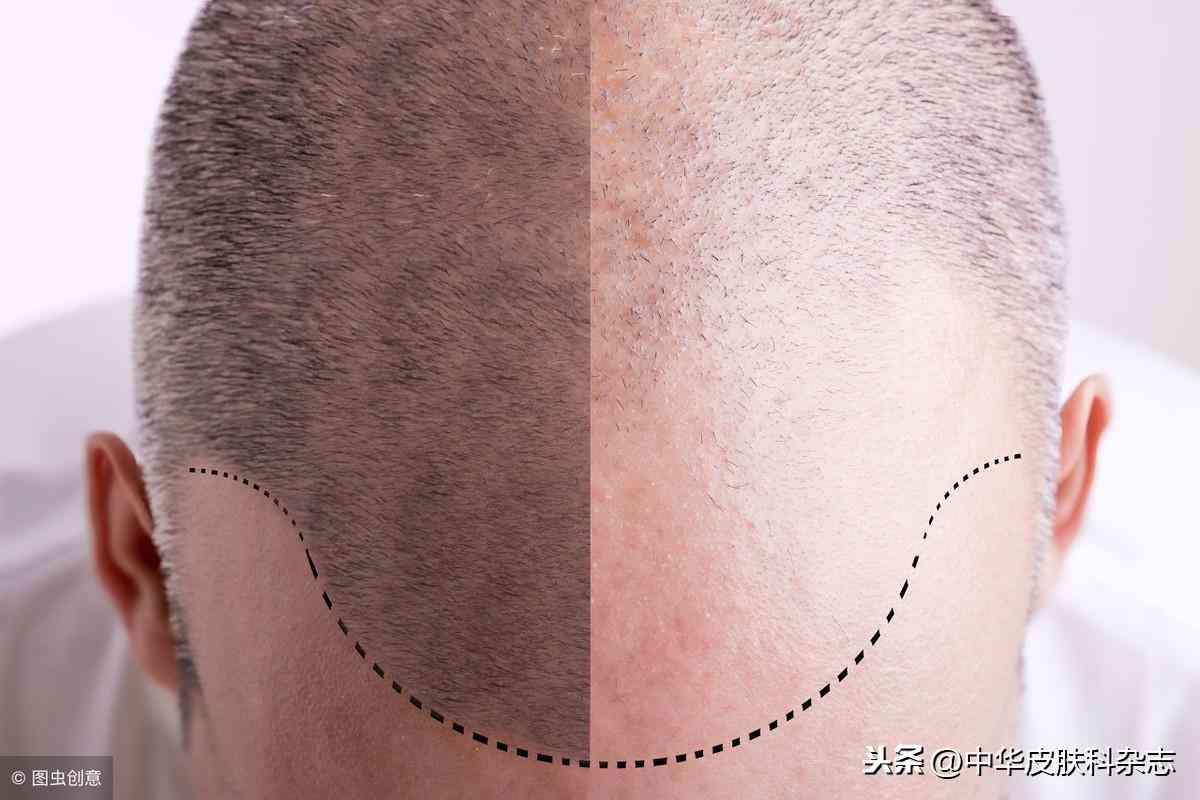 育发类化妆品的活性成分(什么成分可以育发)插图4