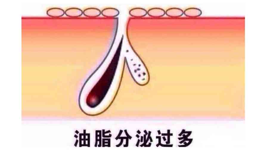 化妆品可以去油脂吗(油脂的皮肤用什么化妆品好)