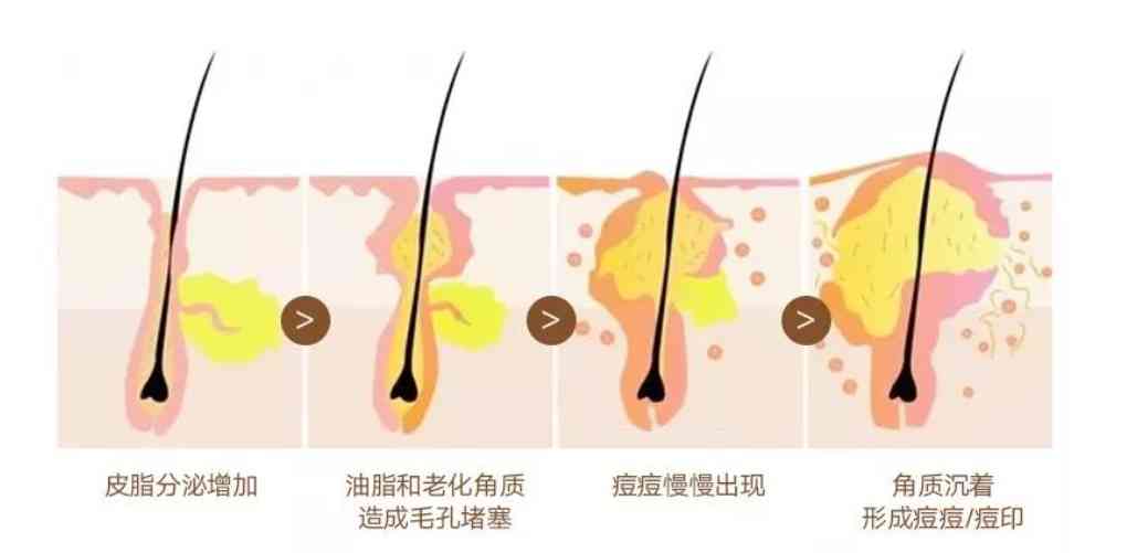 化妆品可以去油脂吗(油脂的皮肤用什么化妆品好)插图3 化妆品可以去油脂吗(油脂的皮肤用什么化妆品好)插图3