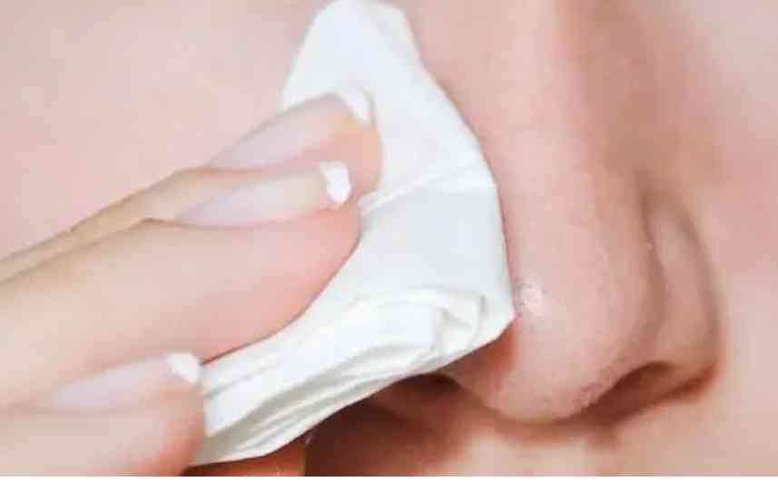 化妆品可以去油脂吗(油脂的皮肤用什么化妆品好)插图8 化妆品可以去油脂吗(油脂的皮肤用什么化妆品好)插图8