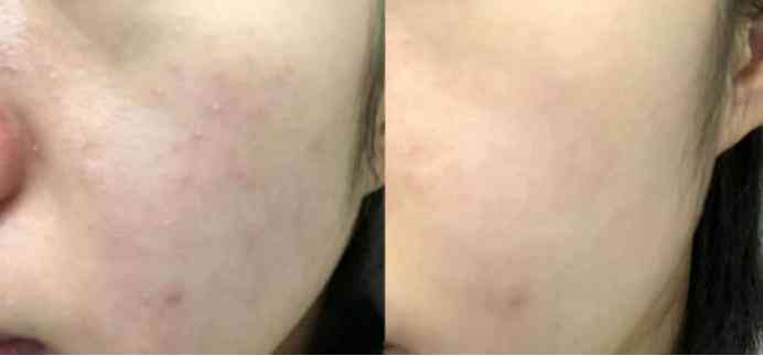 孕期国货化妆品(孕期可用护肤品国货)插图6