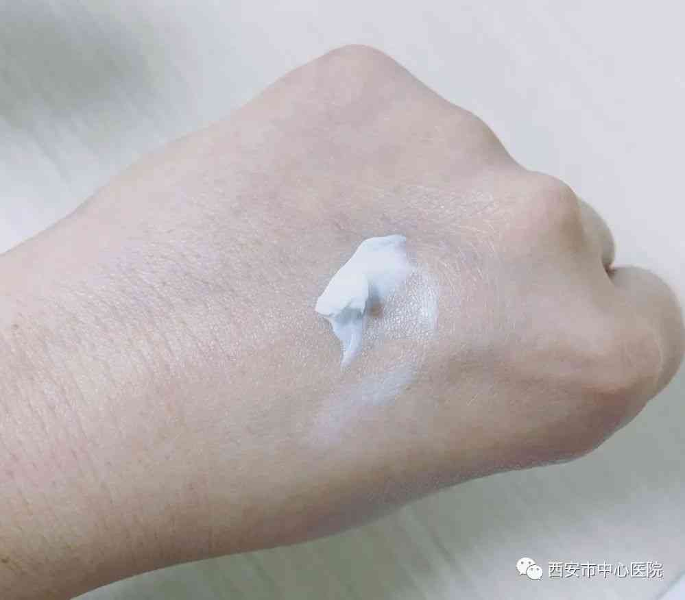 维生素e和化妆品冲突吗(维生素e作为化妆品成分)插图2