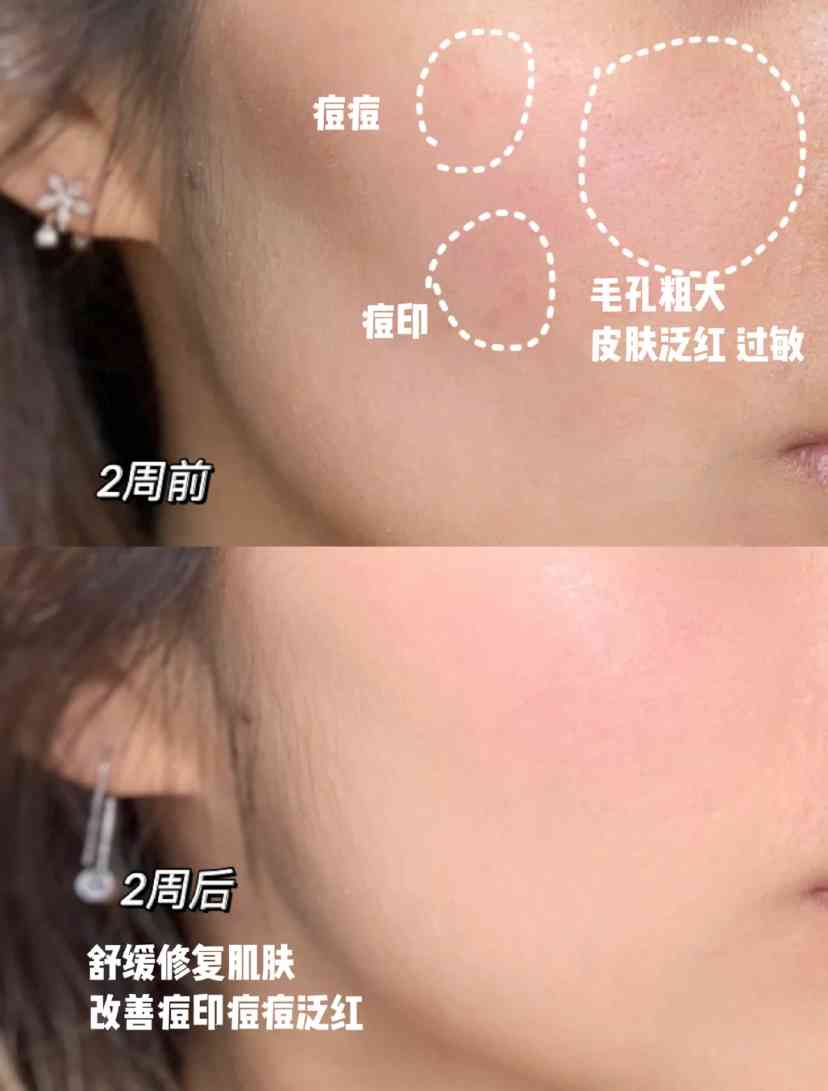 化妆品黑曜石系列(护肤品黑曜石)插图4