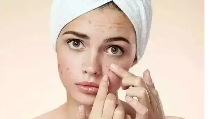 化妆品去痘印效果好(化妆品去痘印效果好的牌子)