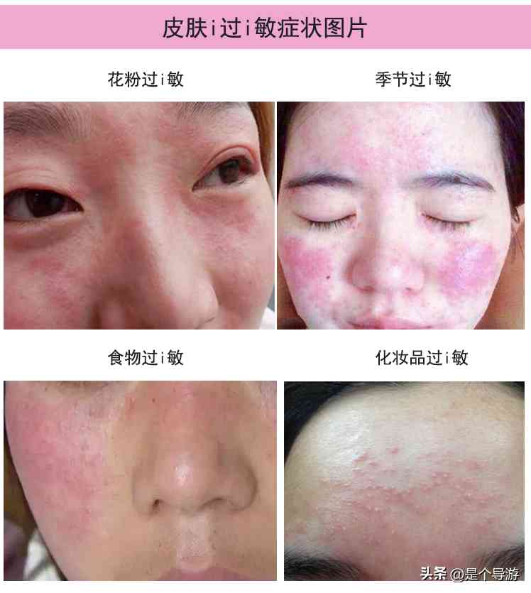 过敏好了可以擦化妆品(过敏好了可以擦化妆品嘛)